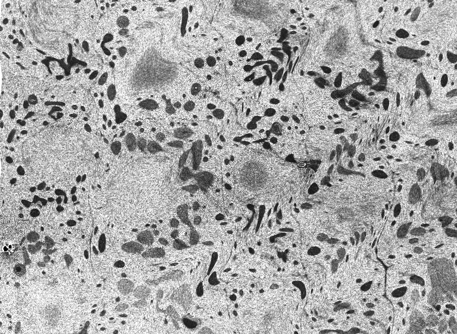 Black and white cryoSEM image of root meristem cells