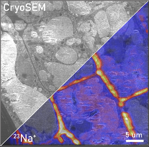 CryoSEM image and Na map in a cell